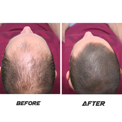 Natural Hair Oil - 100ml